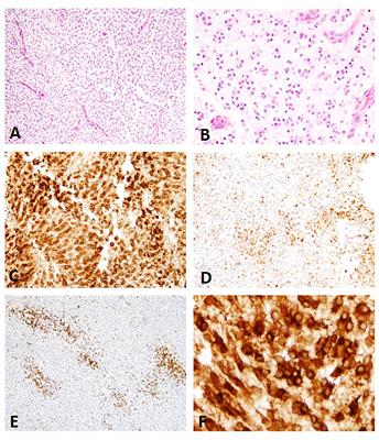 Microtubule-Associated Protein 2 Expression in Canine Glioma